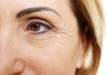 Was hilft wirklich gegen Falten unter den Augen? 7 effektive Tipps gegen Augenfalten!